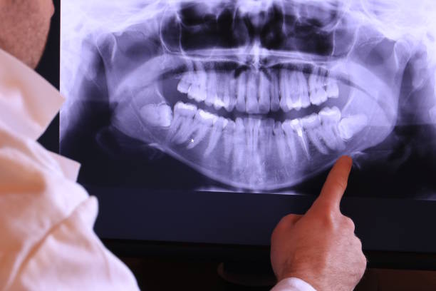 Best Urgent Care for Lost Fillings or Crowns in Clinton, WA