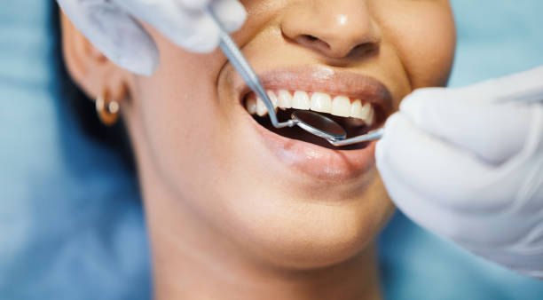 Best Emergency Root Canal Treatment in Clinton, WA